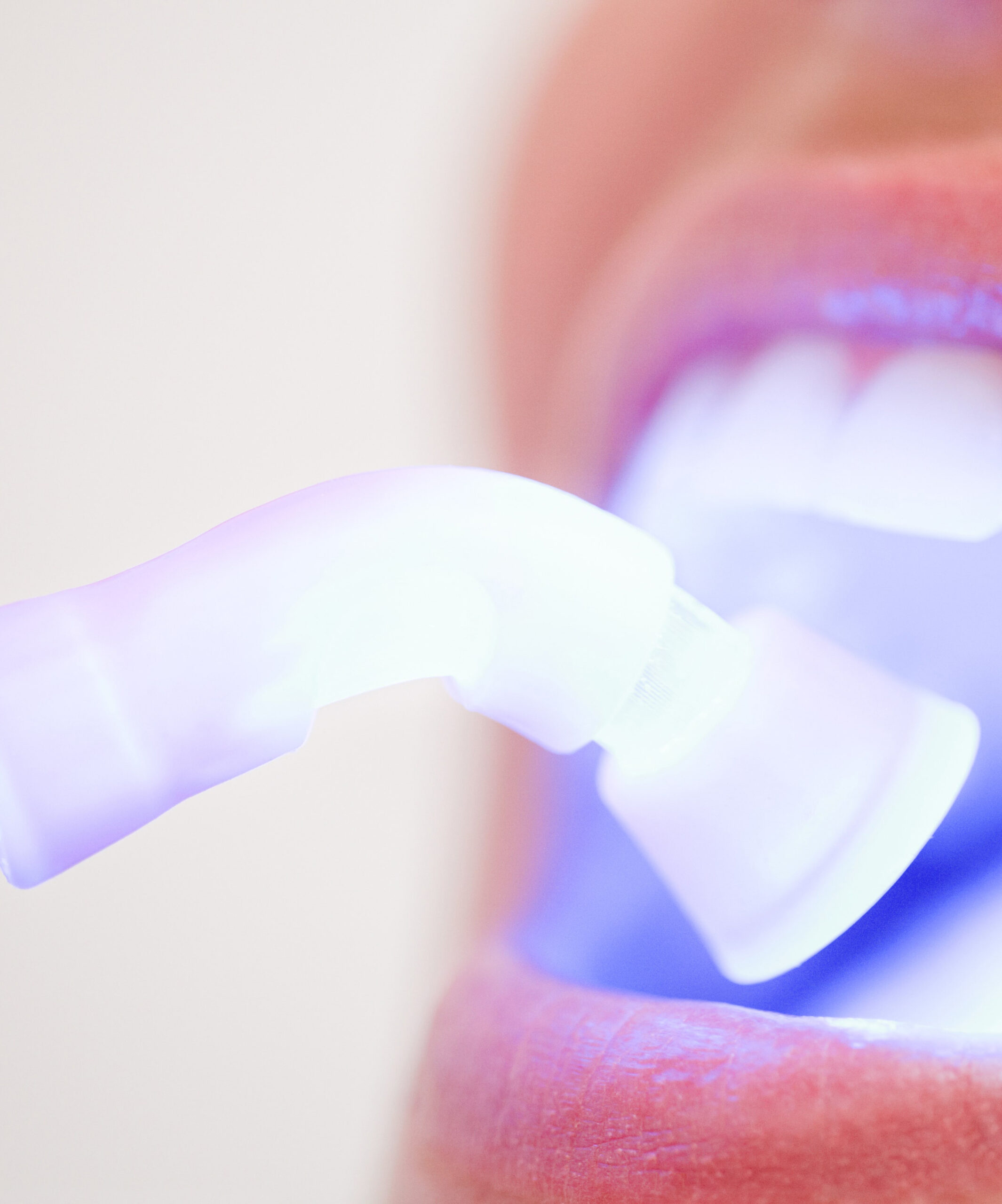 odontoterapia - cabinet stomatologic Smile Architects