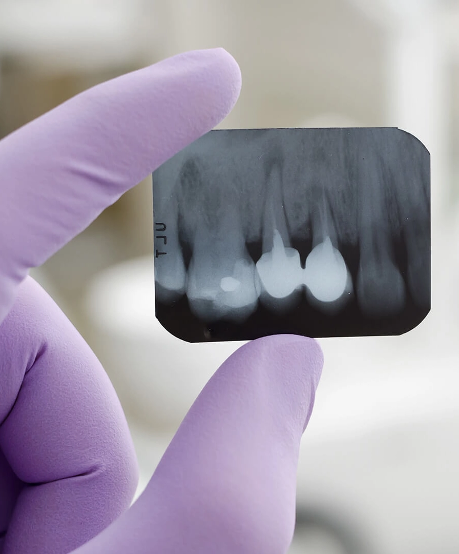 Consultatie cabinet stomatologic